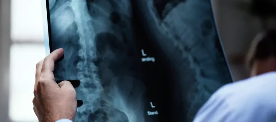 Tüm Spinal MR 6 Tüm Spinal MR